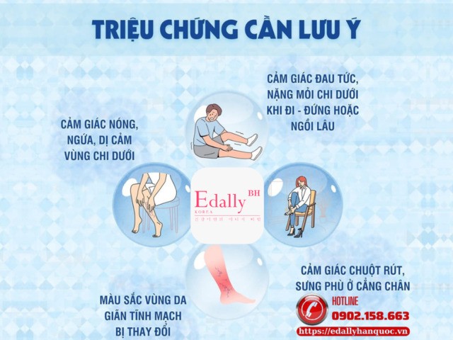 Dấu hiệu nhận biết bệnh suy giãn tĩnh mạch chi dưới