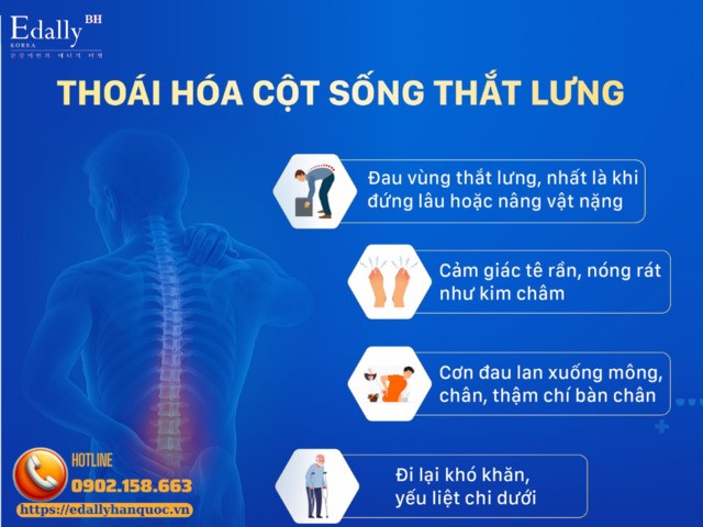 Các triệu chứng của bệnhThoái hóa cột sống thắt lưng