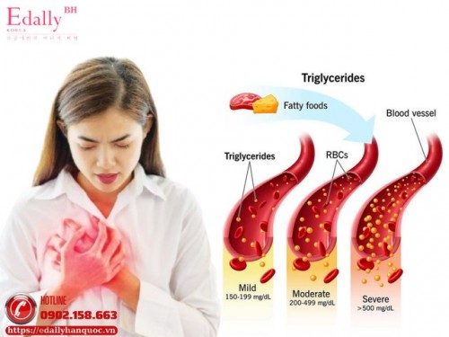 Triglycerid - Hiểu Để Còn Kiểm Soát