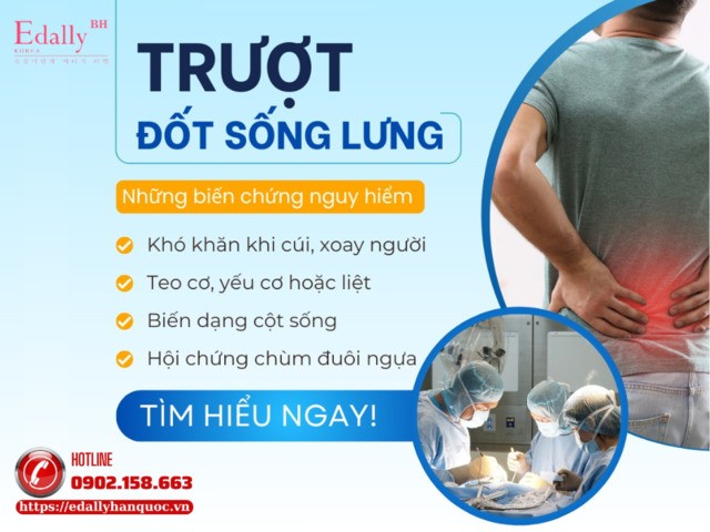 Trượt đốt sống lưng và những biến chứng nguy hiểm