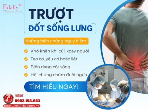 Điều Trị, Luyện Tập Và Dinh Dưỡng Cho Người Bệnh Trượt Đốt Sống Lưng