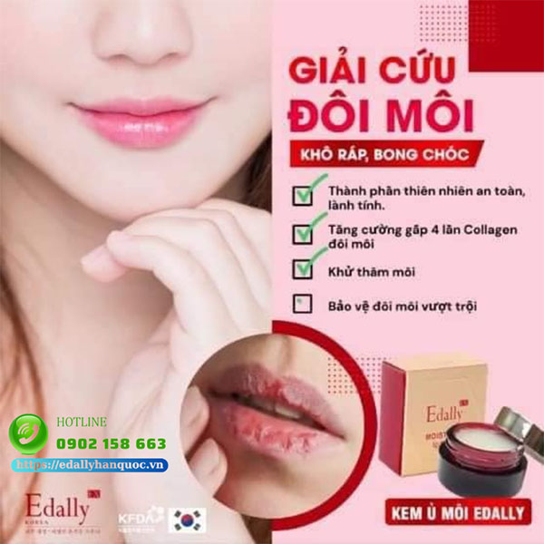 Ủ môi Edally EX - Giải cứu đôi môi khô sần, bong tróc