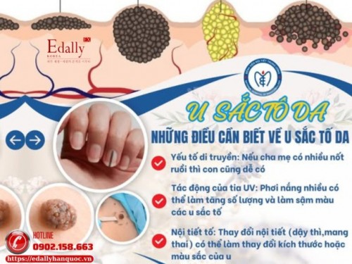 U Sắc Tố Da: Nguyên Nhân, Triệu Chứng Và Cách Điều Trị, Phòng Ngừa