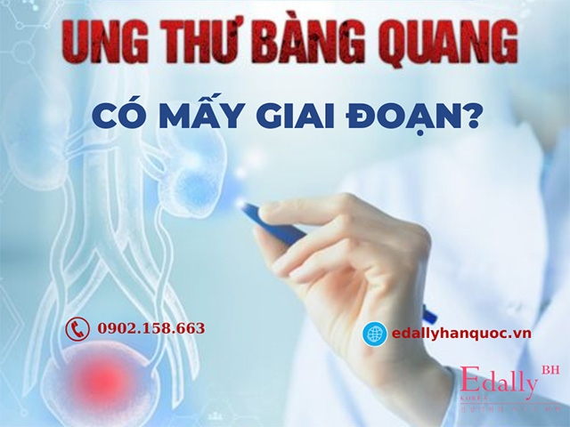 Các giai đoạn của bệnh ung thư bang quang