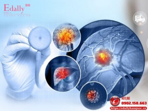 Ung Thư Và Rối Loạn Chuyển Hóa 