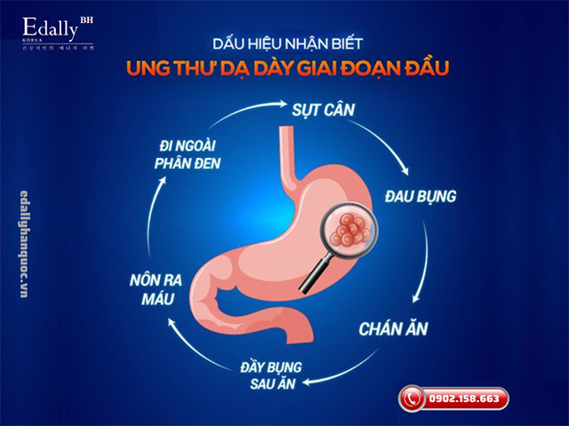 Triệu chứng của Bệnh ung thư dạ dày ở giai đoạn đầu