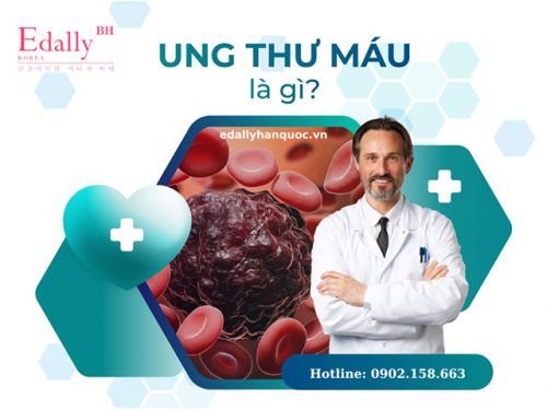 Bệnh Ung Thư Máu Là Gì? Những Triệu Chứng Của Bệnh Ung Thư Máu Thường Gặp