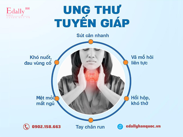 Bệnh ung thư tuyến giáp