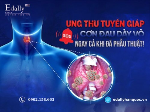 Ung Thư Tuyến Giáp - Hiểu Bệnh Để Ngừa Bệnh Kịp Thời