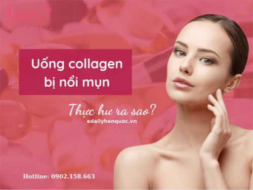 Uống Collagen Thường Xuyên Có Bị Nóng Và Nổi Mụn Không?