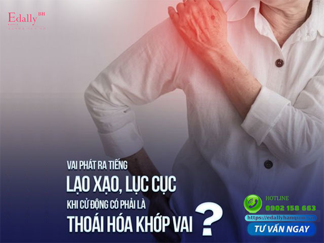 Vai phát ra tiếng lạo xạo, lục cục khi cử động có phải là thoái hóa khớp vai?