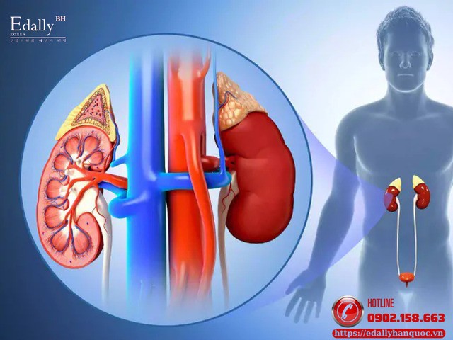 Béo hay gầy đều không tốt cho thận: Vấn đề cân nặng trong bệnh thận mạn (CKD)