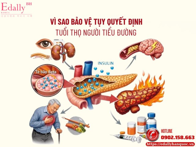 Vì Sao Bảo Vệ Tụy Quyết Định Tuổi Thọ Người Tiểu Đường?