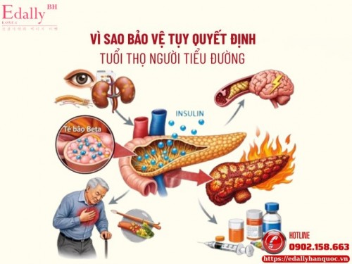 Vì Sao Bảo Vệ Tụy Quyết Định Tuổi Thọ Người Tiểu Đường?