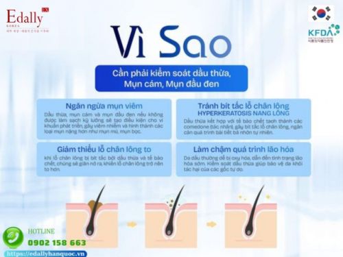 Kiềm Dầu Là Giảm Mụn - Hiểu Sao Cho Đúng?