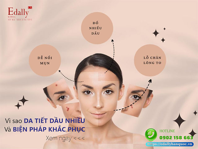 Vì sao da đổ nhiều dầu và cách khắc phục như thế nào?