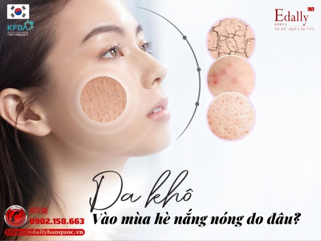 Vì Sao Da Khô Vào Mùa Hè Nắng Nóng?