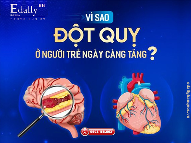 Vì sao đột quỵ ở người trẻ tuổi ngày càng tăng?