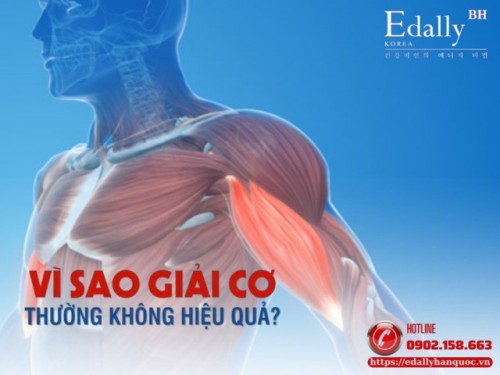 Vì Sao Giải Cơ Thường Không Hiệu Quả - Góc Nhìn Chuyên Môn Để Trị Liệu Đúng Cách