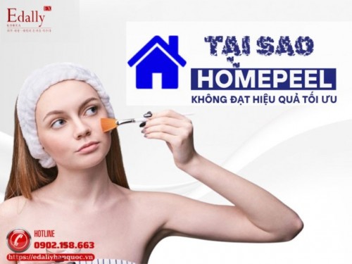 Gỡ Nút Thắt Khiến Quy Trình Homepeel Không Đạt Được Hiệu Quả Tối Ưu