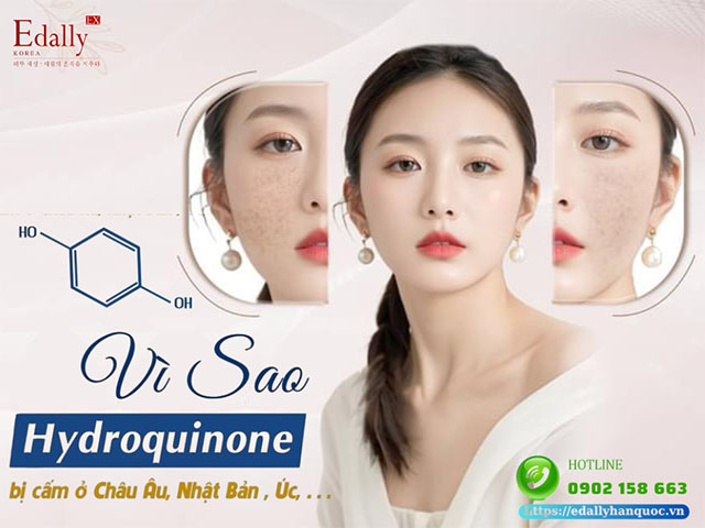 Tại sao Hydroquinone bị cấm ở Châu Âu, Nhật Bản, Úc…?