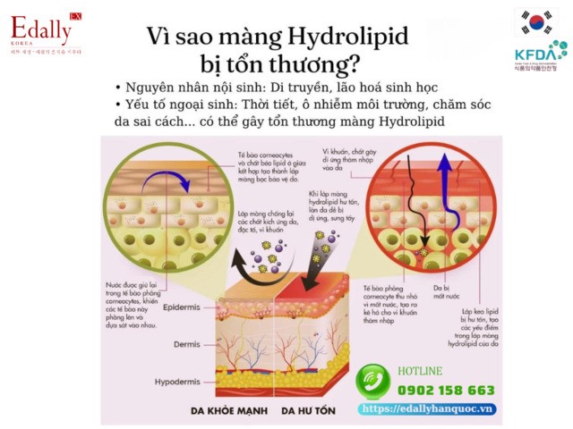 Tại sao lớp màng Hydrolipid của da bị tổn thương?