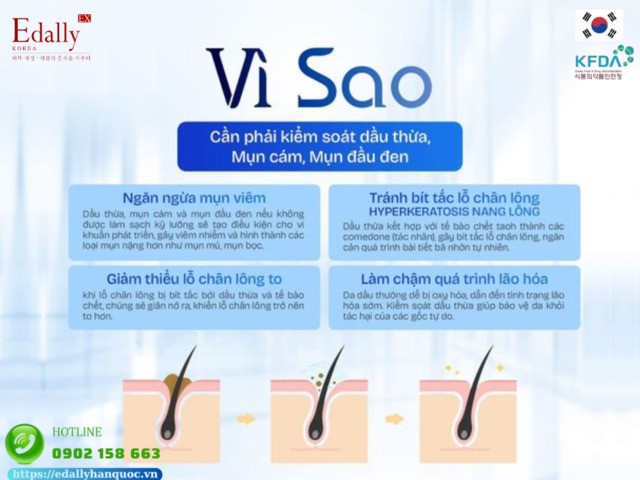 Vì sao cần phải kiểm soát dầu thừa, mụn cám, mụn đầu đen trên da?