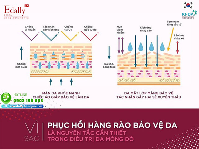 Vì sao phục hồi hàng rào bảo vệ da là nguyên tắc cần thiết trong điều trị da mỏng yếu?