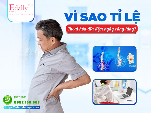 Vì sao tỉ lệ thoái hóa đĩa đệm ngày càng gia tăng?