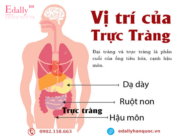 Vị trí của bệnh ung thư trực tràng