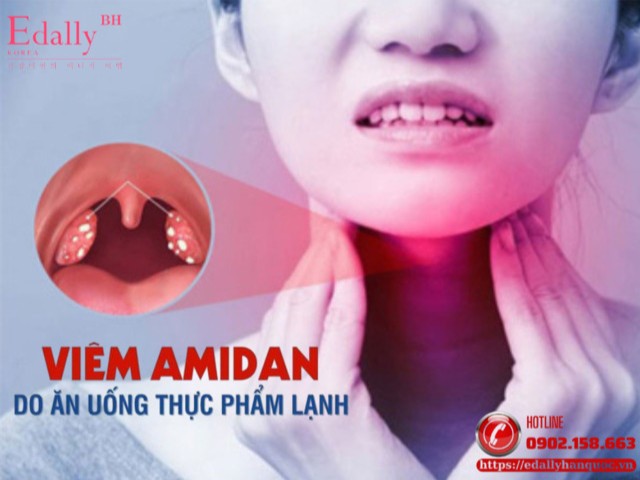Viêm Amidan Do Ăn Uống Thực Phẩm Lạnh
