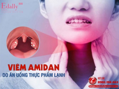 Viêm Amidan Do Ăn Uống Thực Phẩm Lạnh