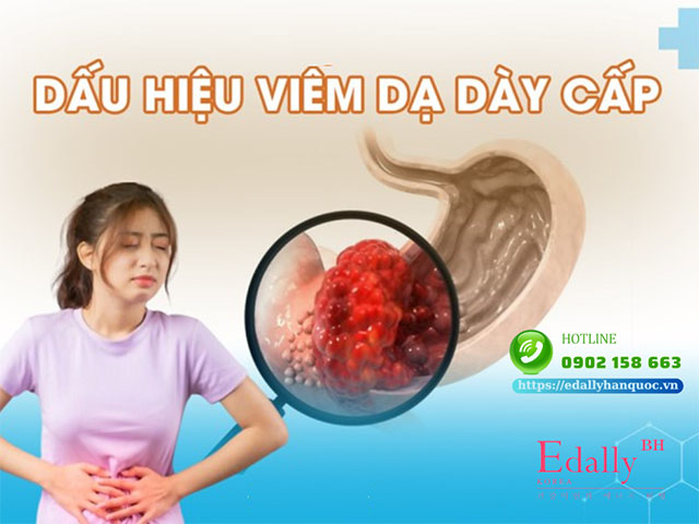 Viêm dạ dày cấp - Nguyên nhân, triệu chứng và cách điều trị hiệu quả