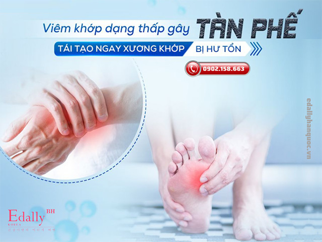 Viêm khớp dạng thấp gây biến chứng tàn phế cho người bệnh