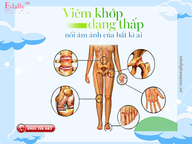 Bệnh viêm khớp dạng thấp - Nỗi ám ảnh của bất kì ai