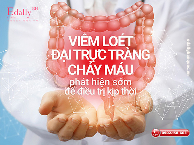 Bệnh viêm loét đại trực tràng chảy máu cần phát hiện sớm để điều trị kịp thời?