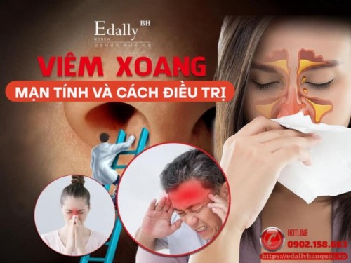 Cách Điều Trị Viêm Xoang Mạn Tính Bằng Kết Hợp Đông Tây Y