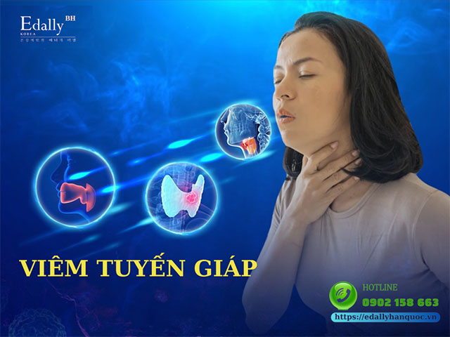 Viêm Tuyến Giáp Là Gì, Có Nguy Hiểm Không, Điều Trị Thế Nào?