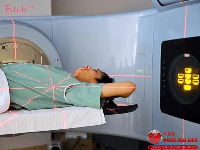 Xạ trị là một trong những phương pháp điều trị bệnh To đầu chi