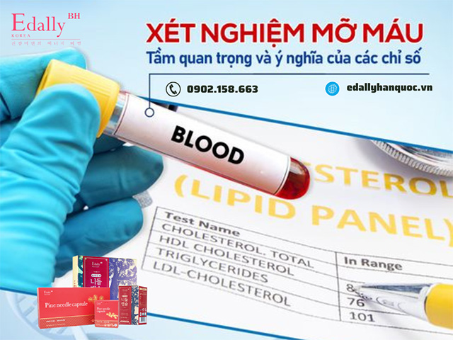 Xét nghiệm mỡ máu - Tầm quan trọng và ý nghĩa của các chỉ số mỡ máu