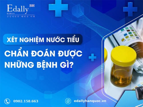 Xét Nghiệm Nước Tiểu Chẩn Đoán Được Bệnh Gì?