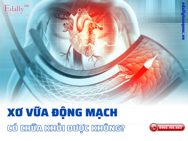 Xơ vữa động mạch có nguy hiểm không, có chữa khỏi được không?