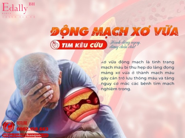 Xơ vữa động mạch - hiểu đúng để không sống trong lo sợ
