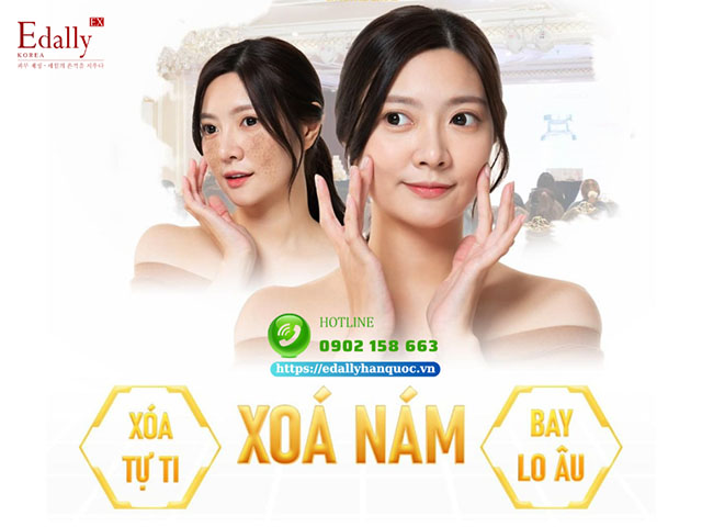 Xóa nám da - Xóa tự ti, đánh bai lo âu