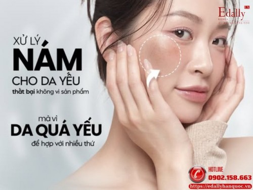 Xử Lý Nám Trên Nền Da Yếu Tại Sao Nhiều Người Bị Thất Bại?