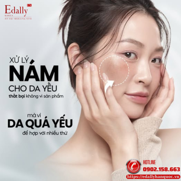 Xử lý nám trên nền da yếu thất bại không vì sản phẩm mà vì da quá yếu để hợp với nhiều thứ