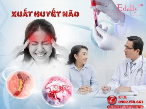 Xuất Huyết Não Nguy Hiểm Như Thế Nào Và Làm Sao Để Phòng Ngừa?