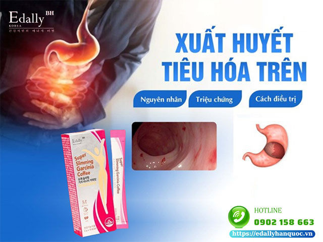 Xuất Huyết Tiêu Hoá Trên - Nguyên Nhân, Triệu Chứng Và Cách Điều Trị Hiệu Quả