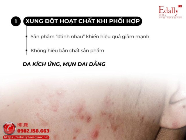 Xong đột hoạt chất khi kết hợp sản phẩm trị mụn khiến mụn ngày càng tệ hơn