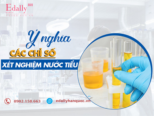 Ý nghĩa các chỉ số xét nghiệm nước tiểu